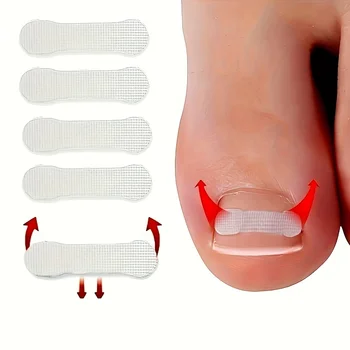 10 шт. пластырь для ногтей, корректор для восстановления ногтей на ногах, быстрая клейкая полоска